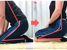 杉本接骨鍼灸院/膝の症状例：施術を受けた方の声