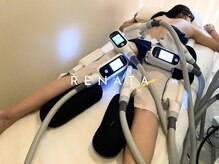 レナータ 渋谷店(RENATA)/【８カップ】装着実例