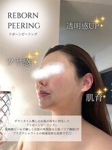 ブリリオプラス 四条烏丸店(Brillio plus)/REBORNピーリング