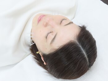 ワン(One)/ニキビケアに特化した美容鍼