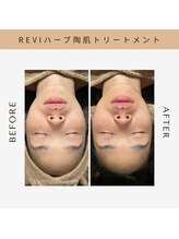 ブリエ(BRiLLER)/#REVI陶肌トリートメント