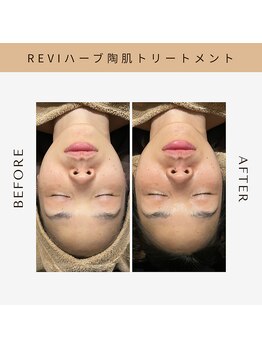 ブリエ(BRiLLER)/#REVI陶肌トリートメント