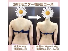 スワン 新栄店(SWAN)の雰囲気(背中美人☆ダイエット/痩身/)