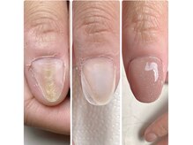 スマイルニコ(smile nico)/長年の悩みを終わらせます