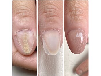 長年の悩みを終わらせます