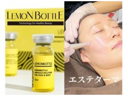 ノーマ(NORMA)の写真