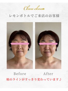 シュシュ(Chouchou)/レッドショット1回