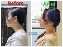 整体院 健勝(けんしょう)/ストレートネック矯正