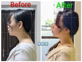 整体院 健勝(けんしょう)/ストレートネック矯正