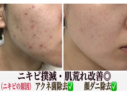 美的アヴェニール(美的.Avenir)の写真