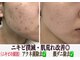 美的アヴェニール(美的.Avenir)の写真