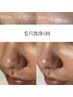 【30日以内の再来】毛穴洗浄+顏WAX