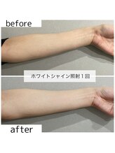 リブ(Lib)/ホワイトシャイン