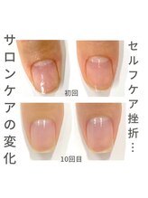 ブリエネイル/最強ネイルケア