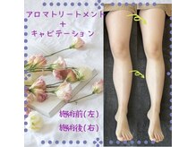 アピアランスビューティー 浦和店/太ももがすっきり引き締まる☆