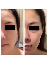 サロン リーナ 北千住店(Salon Lena)/こだわりの自社製品VinatuleW-UP