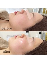 ラ フルール(La Fleur)/オイルハンドマッサージエステ