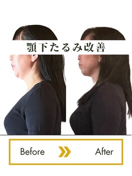ロータス(LOTUS)/年齢によるお悩みにも