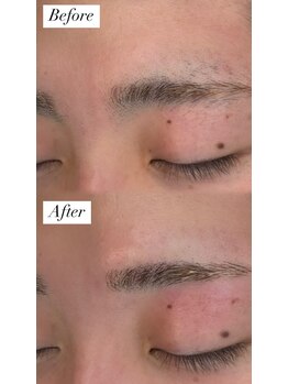 ビュー テンジン 天神 大名(VIEW TENJIN)/アイブロウ（眉毛）ワックス脱毛