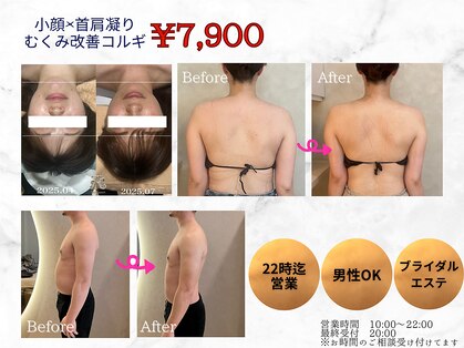 レディアンスの写真
