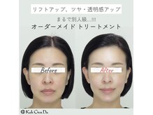 江原道 銀座サロン(Koh Gen Do)の雰囲気（あなたの肌に合わせて組み立てるオーダーメイドフェイシャル。）