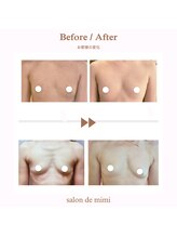 サロン ド ミミ(salon de mimi)/バストアップBeforeAfter