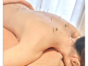 からだとこころ 恵比寿/鍼灸