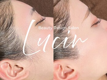 ルシール 仙台店(lucir)/<フェイスWAX> Before/After