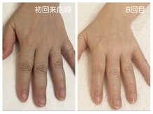 キレイテ 上野店/40代/回目【ハンドケア上野】