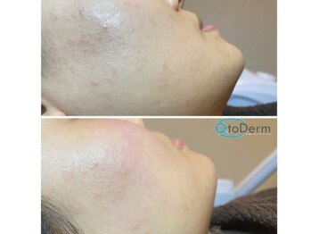 イベリス(Iberis)/デコルテマッサージもあります♪