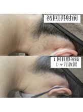 テンパ ビューティー(+10%beauty)/効果写真