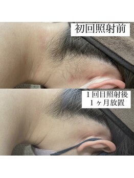 テンパ ビューティー(+10%beauty)/効果写真