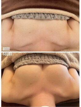 美人バスト 浜松店/◆バストアップ &nbsp;BeforeAfter◆