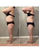 リファラ 光の森店(REFALA)/【痩身/30代女性】約3ヶ月の結果