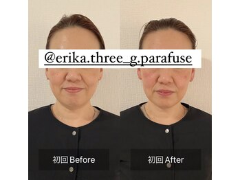 スリージー/before/after