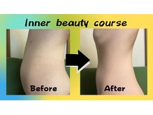 J'Sメディカル整体院 藤沢/インナービューティ