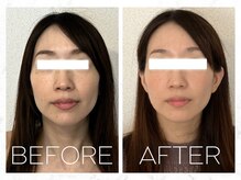 コノハナ(conohana)/輪郭が変わると雰囲気も変わる♪