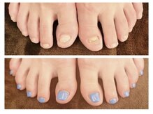 グラシナ 鳥丸店/深爪は手だけではありません