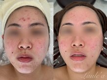 プライベートサロン ラウレア(Laule'a)/