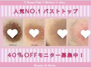 ボーテドリッシュ(Beaute de Riche)/ローマピンク【バストケア】