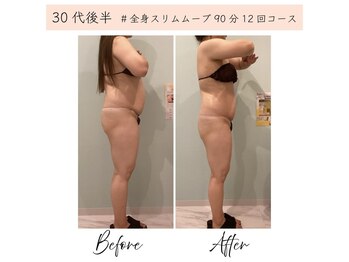 Melrose 銀座店 【メルローズ】/【お客様の効果写真】