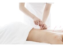 リュウ鍼灸院 サロン ド リュウ(Salon de Ryu)の雰囲気（【鍼灸、かっさ、カッピング】　肩こり、頭痛を根本改善）