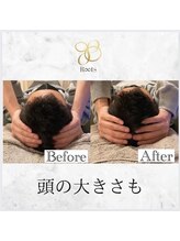 ルーツ(R∞ts)/頭のサイズも♪