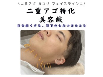 ハリナチュレ 那覇店(HARINATURE)/二重アゴ特化美容鍼