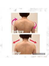 ミエル(Miel)/Before After