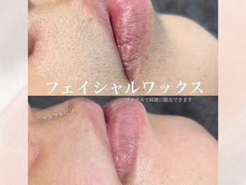 エマイミー 品川(EmayMie)/1部位から選べるフェイシャルWAX
