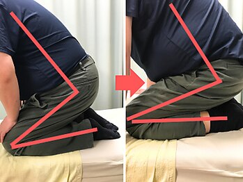 杉本接骨鍼灸院/膝の症状例:施術を受けた方の声