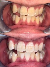 ライトビューティー 池袋店(LightBeauty)/症例写真