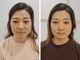 バーンノーク(baan Nook)の写真/首・肩こり・頭痛改善から生まれた小顔矯正の技術♪顔の骨格調整で頭痛や目の疲れを軽減し、リフトアップ◎