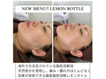 NEWレモンボトルで頬やフェイスラインの脂肪を減らし小顔に♪